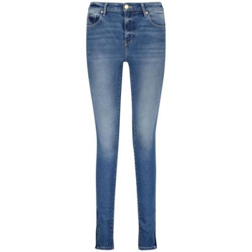 Blossom Zip Skinny Jeans