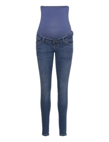 Mlbetty Destroyed Skinny Jeans Mamalicious Blue